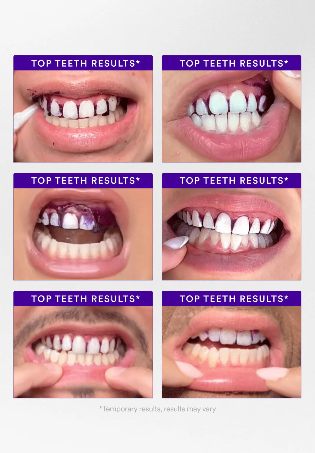 💎V34 Whitening Strips-Purple Tooth Whitening, Tooth Stain Treatment, Combining Whitening and Colour Correction